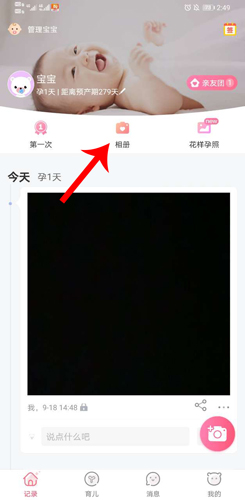 育儿宝上传视频:3步搞定,宝宝成长瞬间秒分享-景澄手游网